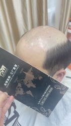 -发饰美男士增发补发假发定制店