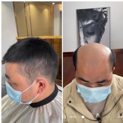 -型男帮男士假发补发·佩戴式发型