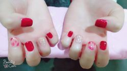 -莲芸拔罐减肥