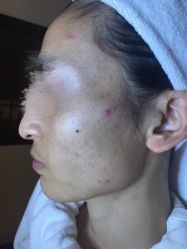 -皇族养心堂·净痘·修敏·御颜