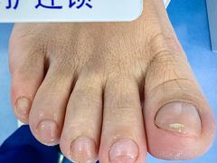 -Andrew指甲专科灰指甲·甲沟炎矫正·3D步态矫形鞋垫定制(浦三路店)