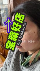 点击看大图 -成都艾特他整形外科医院