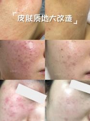 -KISS U 国际美学