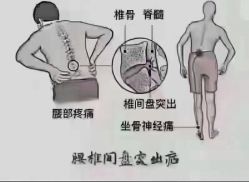 -香薇妮丝女子减肥院