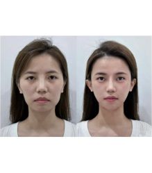 -上海伊莱美医疗美容医院