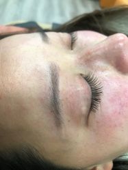 -铂特丽医美·眼鼻整形·光电美肤·注射抗衰