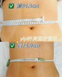 -Lily纤美·科技减脂中心
