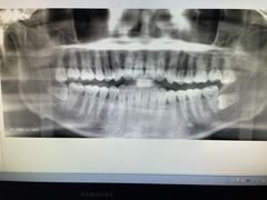 -优伢仕口腔(汽车西站店)