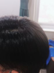 -极客侠男士假发定制补发