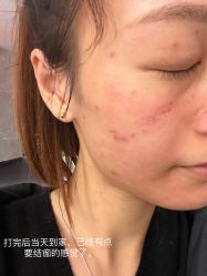 体验后-上海时光整形外科医院