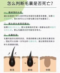 -诗碧曼养发