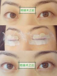 -MIVI半永久纹眉绣眉