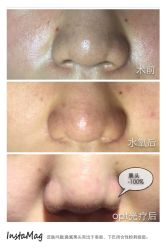 脸部抗衰-光SPA科技美肤