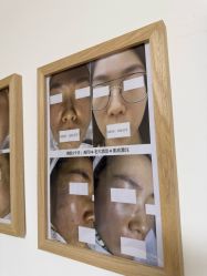 -美肤盾祛痘·问题肌头疗管理中心