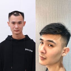 -发饰美男士增发补发假发定制店