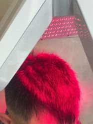 -碧莲盛·不剃发植发