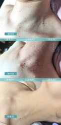 -清疣美疣·痣·斑净肤中心