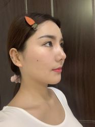体验后-禾美嘉医疗美容