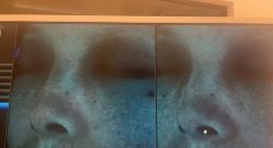-苑苑vbeauty科技美容SPA