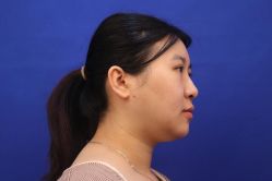 -洁铭新加坡医美