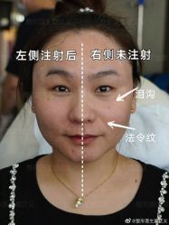 -北京米扬丽格医疗美容·联合丽格鼻整形中心