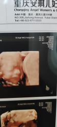 -重庆安琪儿妇产医院-妇幼保健联盟医院
