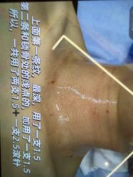 -杭州米兰柏羽医疗美容医院