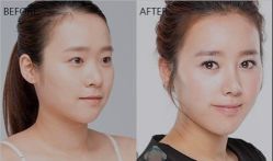 -SKINIST丽铂医疗美容