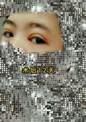 -南宁维密整形·王敦华眼鼻整复中心