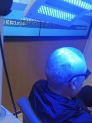 -雍禾植发全国连锁