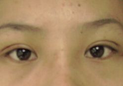 1-伊美尔医疗美容医院