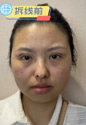 -素美医疗美容·西南眼鼻整形·修复基地