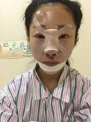 点击看大图 体验后-鑫元辰医疗美容整形