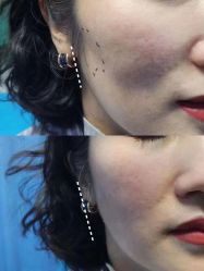 -郡艺医疗美容·微整·眼鼻吸脂