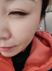 体验前-JS医疗美容