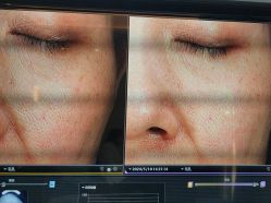 -苑苑vbeauty科技美容SPA