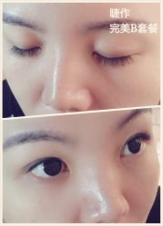 睫毛嫁接-光SPA科技美肤