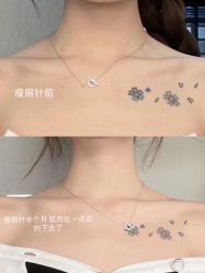 点击看大图 -天津伊美尔医疗整形美容专科医院