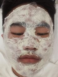 点击看大图 体验后-蕾特恩专业祛痘·皮肤管理