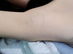 -薇兰专业脱毛连锁机构