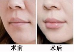 -CMS西美斯·美式医疗美容