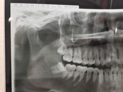 -无锡市第二人民医院(南院)