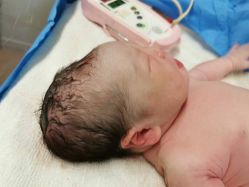 -杭州贝瑞斯美华妇儿医院·早孕·产检·儿科