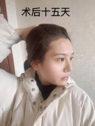 -雍禾植发全国连锁