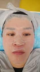 -亿美医疗美容·半岛大超炮官方授权店