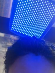 -碧莲盛·不剃发植发