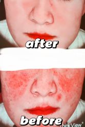 -紫御国际抗衰ZOE ANTI AGING