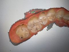 -上海仁爱医院口腔科 · 种植
