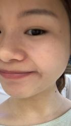 体验后-深圳美莱医疗美容医院