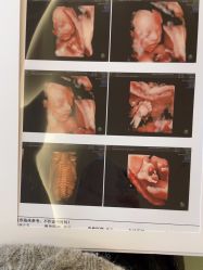 -杭州贝瑞斯美华妇儿医院·早孕·产检·儿科